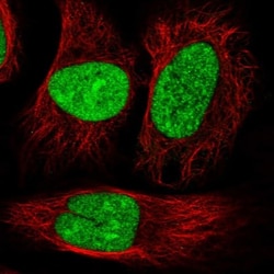 DRB1 Antibody, Novus Biologicals:Antibodies:Primary Antibodies
